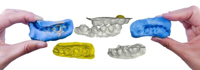 Refurbed: Thunk3D DT 300 3D-Dentalscanner